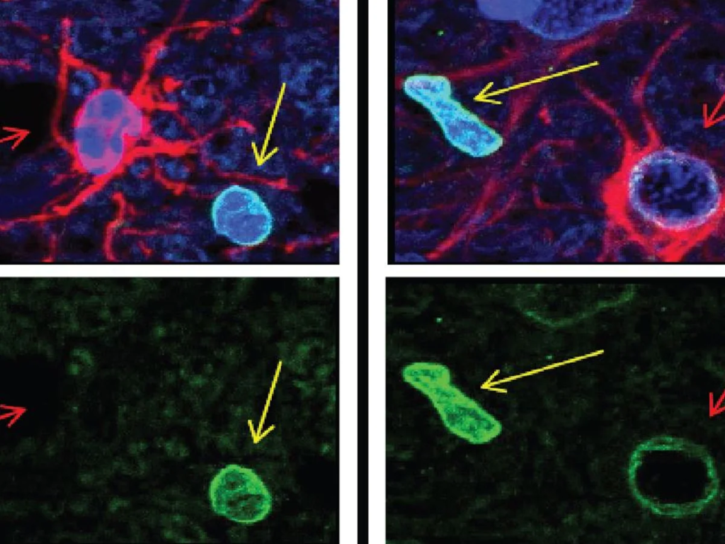 Ejemplos en el cuerpo humano
